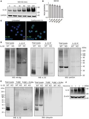 The pro-tumorigenic cytokine IL-32 has a high turnover in multiple myeloma cells due to proteolysis regulated by oxygen-sensing cysteine dioxygenase and deubiquitinating enzymes